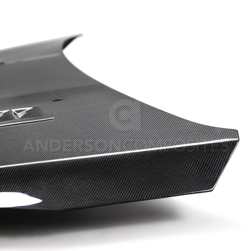 Anderson Composites 2016 - 2017 Ford Focus ST/RS Carbon Fiber RS Hood - My Store