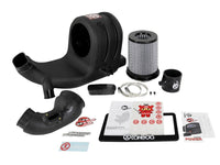 aFe Takeda Momentum Pro DRY S Cold Air Intake System 15 - 18 Honda Fit I4 - 1.5L - My Store